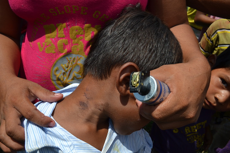 Child showing rubber bullet wound, with a gas grenade in foreground. Photo: courtesy of Movimento Ipereg Ayu.