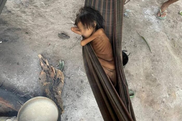 Child affected by severe food insecurity in the Brazilian Amazon